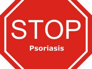 Alles over psoriasis